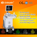 CE &amp; ISO Trolley Ultraschall für Gynäkologie / Geburtshilfe / Urologie &amp; mobile Ultraschall-Scanner in China heißer Verkauf gemacht